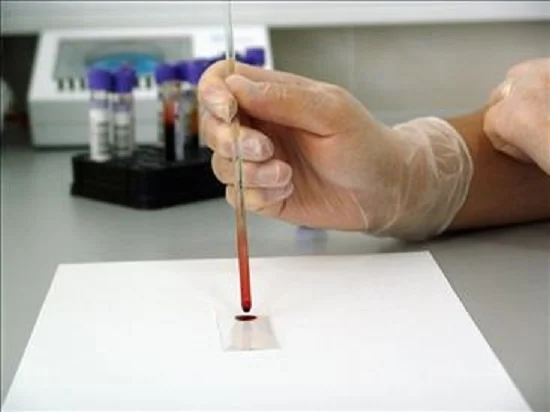 ATROFIA MUSCOLARE SPINALE, AL VIA NELLE MARCHE LO SCREENING NEONATALE